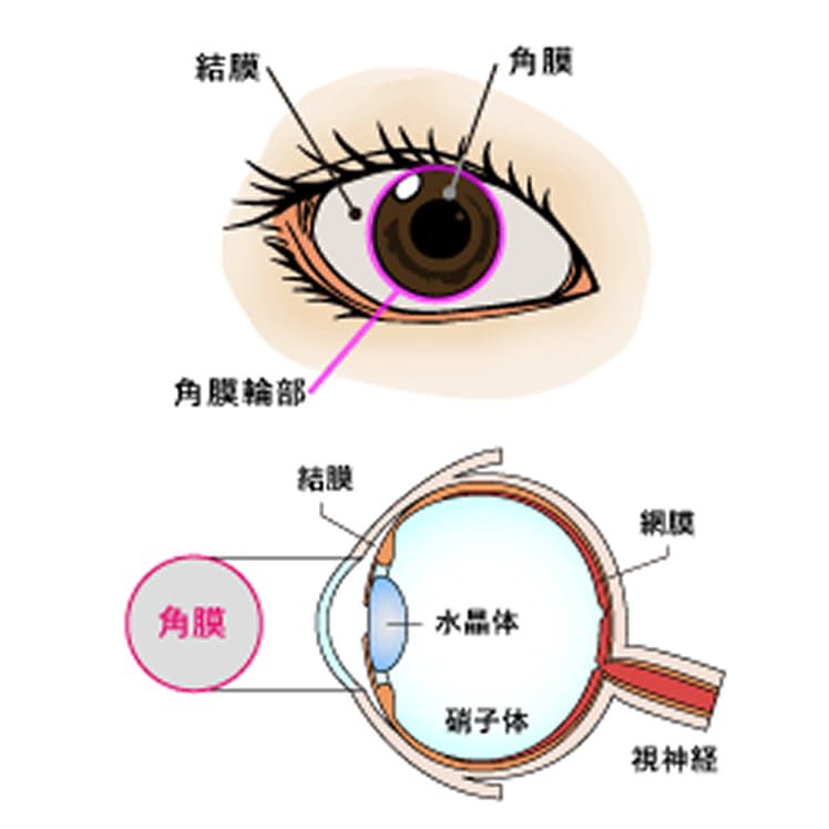 角膜の再生医療 説明図