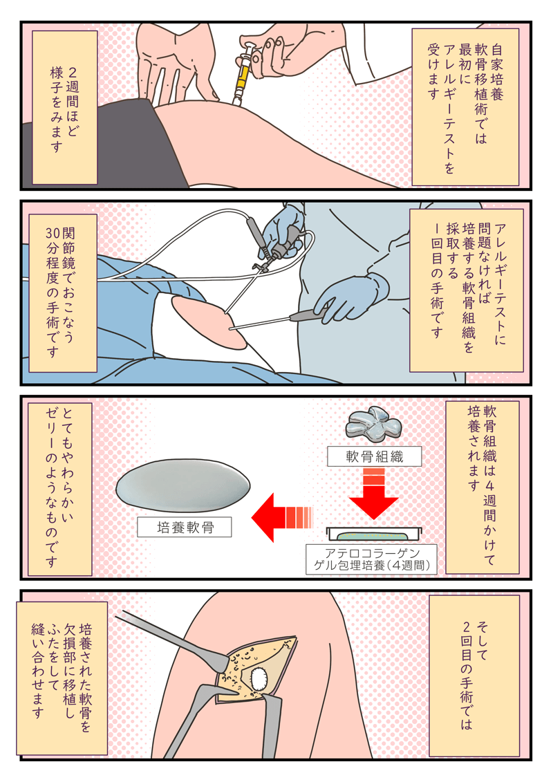 【マンガ　花子ママのひざ物語】ケガと再生医療編 6