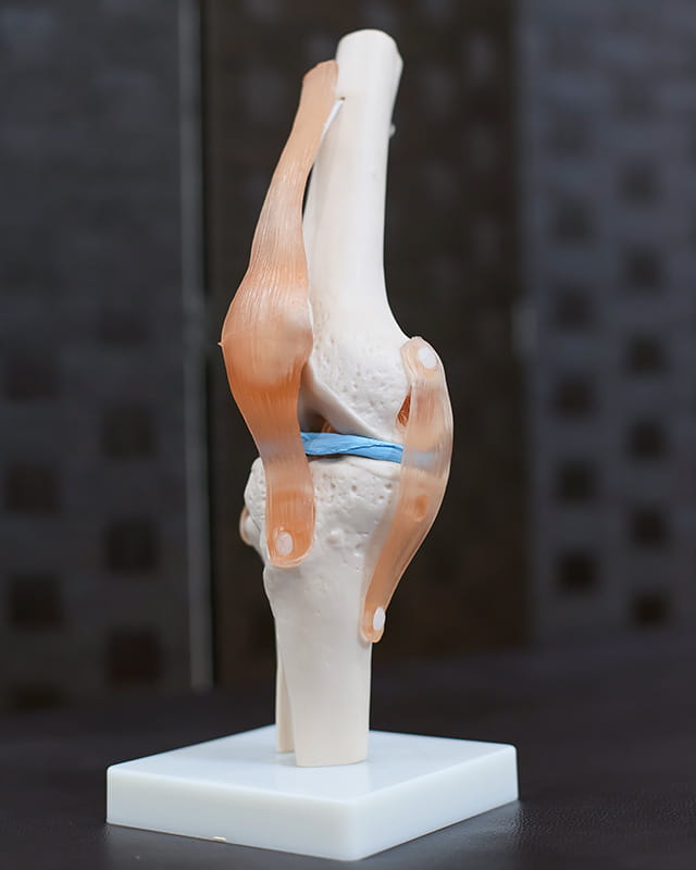 ひざ痛の特徴　腱 系（けんけい）の模型画像