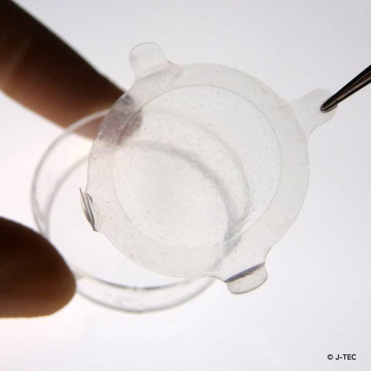 自家培養口腔粘膜上皮