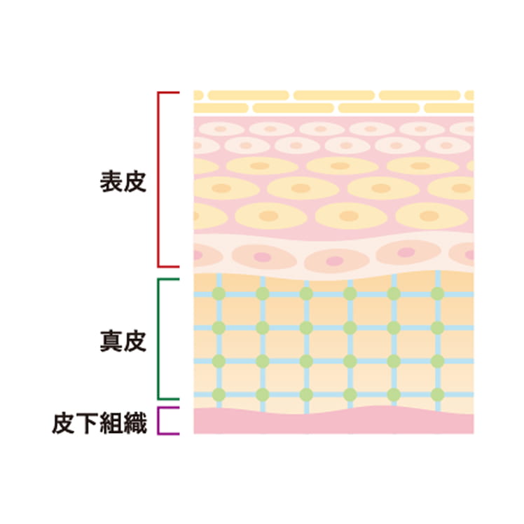 自家培養表皮 熱傷の治療について 説明図