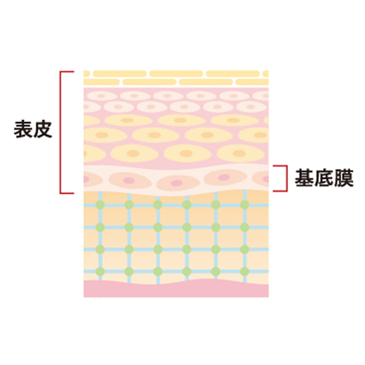 自家培養表皮 表皮水疱症の治療について 説明図
