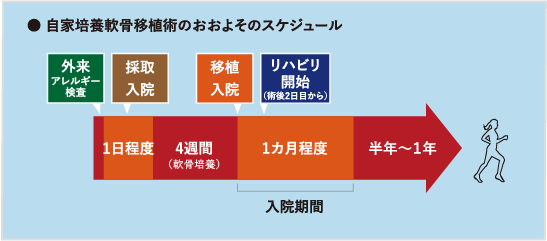 自家培養軟骨移植術のおおよそのスケジュール表