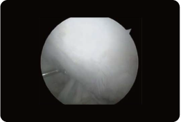 1年後の移植箇所の写真